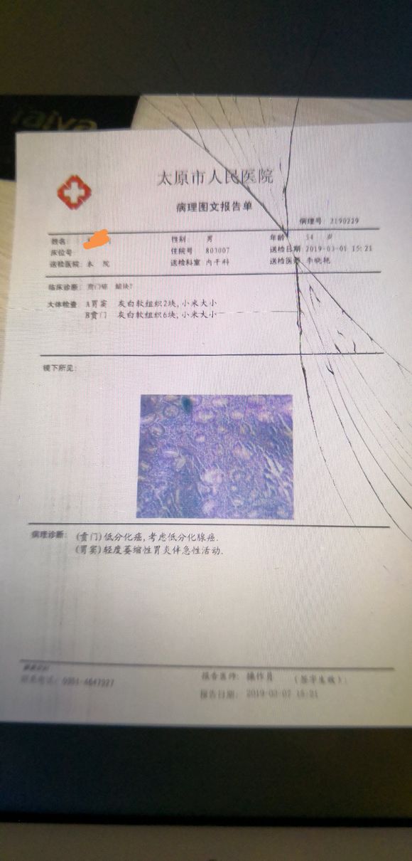 胃癌晚期，不能手术，现在正在化疗。